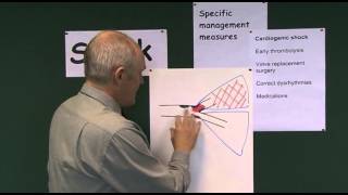 Shock 8 Management of Cardiogenic Shock [upl. by Rorie120]