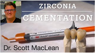 Zirconia Cementation with RelyX Universal Cement  Dr Scott MacLean  Dentist [upl. by Kylander]