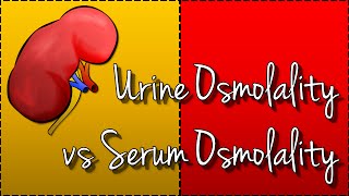 Urine Osmolality vs Serum Osmolality Hyponatraemia [upl. by Lindahl]