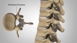 Myelopathy  Patient Education [upl. by Ulani]