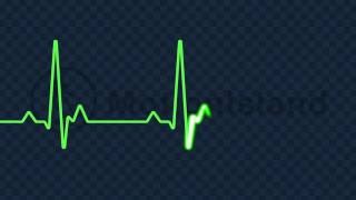 ECG EKG Animation Heart Beat Line Video [upl. by Golter]