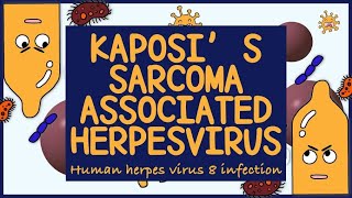 Kaposi Sarcoma Associated Herpes virus HHV 8 Morphology Diagnosis Treatment amp Prevention [upl. by Mirelle]