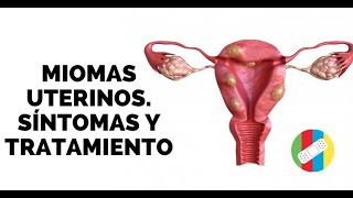 MIOMAS UTERINOS Síntomas y Tratamiento [upl. by Tennies]