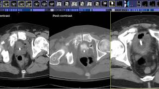 Advanced Imaging Basic Chest CT Anatomy [upl. by Senalda311]