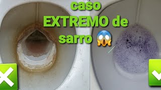 Como limpiar baño lleno de SARRO [upl. by Butler]