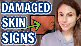 5 Skincare Tips to Clean Unclog amp Minimize Large Pores [upl. by Husch483]