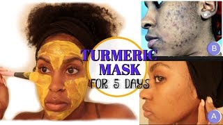 I Used a TURMERIC MASK for 1 Week and THIS HAPPENED  How to Fade Dark Spots [upl. by Enirehtak]