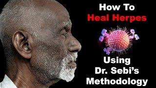 How To Heal Herpes  Using Dr Sebis Methodology [upl. by Yrogerg985]