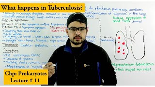 Tuberculosis TB  Causes Treatment Prevention and Transmission [upl. by Noreg]