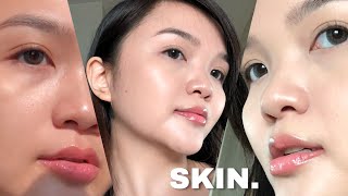 Skin conditions after chemotherapy and radiation [upl. by Selrahcnhoj212]