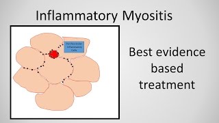 PSSM amp MFM Symptoms Explosive Behaviour [upl. by Marys513]