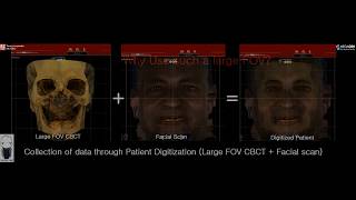 R2GATE Digital oral design DOD Guidelines for full arch treatment planning Dr Sam Omar [upl. by Orabel505]