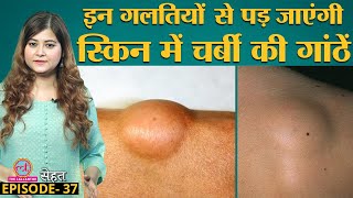 क्या होता है Lipoma जिसमें skin के अंदर चर्बी की गांठ बन जाती है जाने इलाज के तरीके  Sehat Ep 37 [upl. by Jewel]