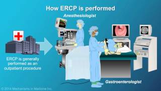 Understanding ERCP Endoscopic Retrograde Cholangiopancreatography [upl. by Ylil]