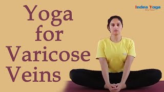 Prevent and cure Varicose Veins with Daily practice of Yoga [upl. by Tterrab]