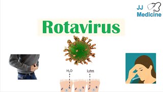 Rotavirus  Risk Factors Pathophysiology Symptoms Diagnosis Treatment [upl. by Mia]