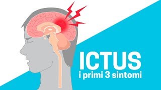 ICTUS i primi 3 sintomi  ForumSalute [upl. by Ilan]