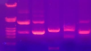 Agarose Gel Electrophoresis  Amrita University [upl. by Aibos]