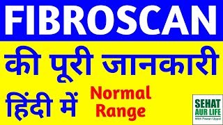 Fibroscan Of Liver In Hindi Fibroscan Of Liver Normal Range Liver Fibroscan Results In Hindi [upl. by Asirret491]