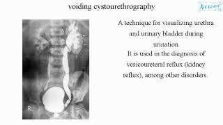 voiding cystourethrography [upl. by Stormie]