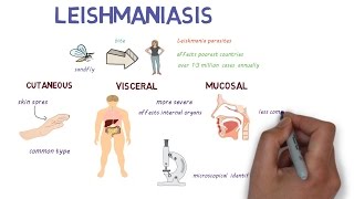 What is Leishmaniasis An introduction and overview [upl. by Laro]