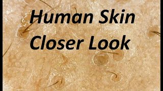 A Closer Look At Human Skin Under Microscope [upl. by Bremble100]