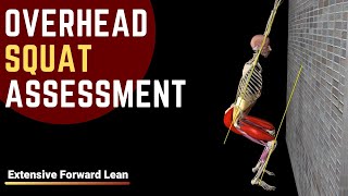 Overhead Squat Assessment  Extensive Forward Lean [upl. by Zicarelli]