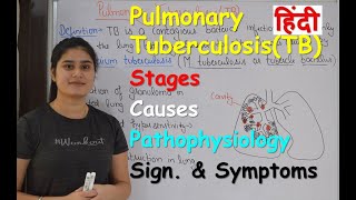 Pulmonary Tuberculosis in Hindi  Stages  Causes  Pathophysiology  Sign amp Symptoms [upl. by Ewold775]