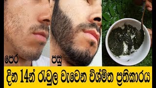 දින 14 න් රැවුල වැවෙන විශ්මිත ආලේපනයක්  Rewla Wawena Beheth  How To Grow Beard Faster [upl. by Rapsac]