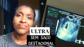 ULTRASSOM SEM SACO GESTACIONAL Minha experiência l Roberta Rodrigues [upl. by Nerrawed548]