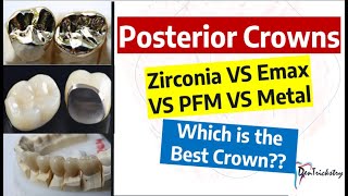 DENTAL CROWN TYPES Zirconia Emax PFZ PFM Metal Choosing the BEST [upl. by Medin944]