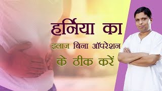 Ayurvedic Treatment for Hernia  Acharya Balkrishna [upl. by Einaoj872]