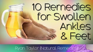 10 Home Remedies for Swollen Feet and Ankles [upl. by Elayor859]