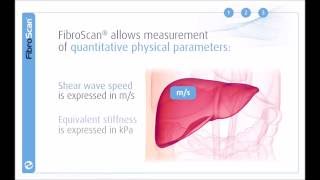 3 Stages of the FibroScan examination [upl. by Donoho430]