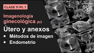 111  Imagen Ginecológica Métodos de estudio y patología endometrial [upl. by Irem]