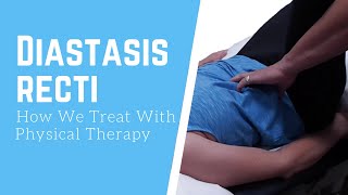 How We Treat Diastasis Recti  Physical Therapy [upl. by Horwath]