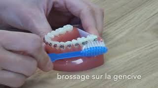 Comment brosser ses dents avec un appareil [upl. by Ariaes275]