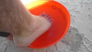 Best Athletes Foot Cure Chlorine Shock Treatment [upl. by Noram]