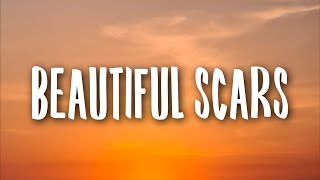 Maximillian  Beautiful Scars Lyrics [upl. by Adrahs]