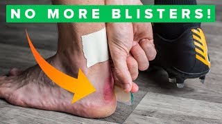 How to never get blisters again  Top 5 blister hacks [upl. by Alanson]