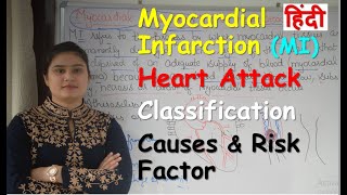 Myocardial Infarction or Heart Attack in Hindi  Classification  Causes amp Risk Factor [upl. by Egroeg602]