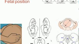 Fetal lie presentation and position [upl. by Grethel435]