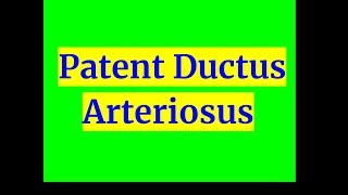 Patent Ductus Arteriosus [upl. by Zennie]