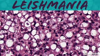 Leishmaniasis 5Minute Pathology Pearls [upl. by Paulette856]