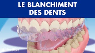 Blanchiment dentaire © [upl. by Onaled]