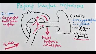 Heart Murmurs and Valve Disease Heart Murmur Series [upl. by Yerfdog]