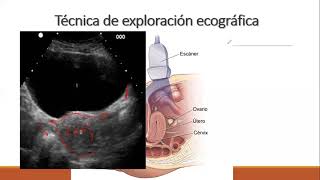 ULTRASONIDO PELVICO MEDIDAS ANATOMIA TECNICAS [upl. by Stanzel]