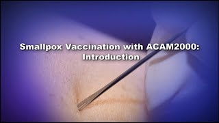 Chapter 1 Smallpox Vaccination with ACAM2000 Introduction [upl. by Alyat]