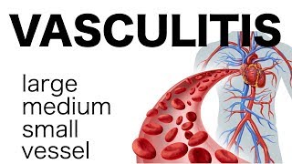 Vasculitis [upl. by Bahe]