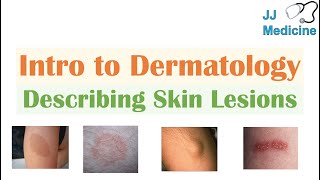 Introduction to Dermatology  The Basics  Describing Skin Lesions Primary amp Secondary Morphology [upl. by Sondra]